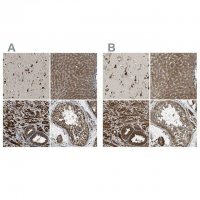 Anti-ERGIC1 antibody produced in rabbit HPA018666-100UL
