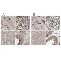 Anti-ERLEC1 antibody produced in rabbit 