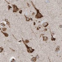 Anti-ERLEC1 antibody produced in rabbit 