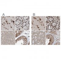 Anti-ERLEC1 antibody produced in rabbit HPA031502-100UL