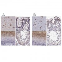 Anti-ERO1A antibody produced in rabbit 