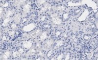 Anti-Erythropoietin Antibody, clone 6E5, ZooMAb� Rabbit Monoclonal 