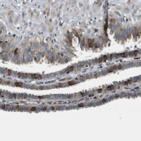 Anti-ESYT1 antibody produced in rabbit HPA016858-100UL