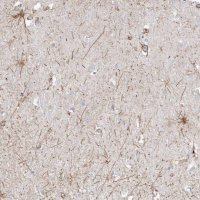 Anti-ETAA1 antibody produced in rabbit
