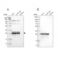 Anti-ETFB antibody produced in rabbit 