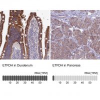 Anti-ETFDH antibody produced in rabbit 
