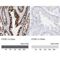 Anti-ETHE1 antibody produced in rabbit HPA028360-100UL