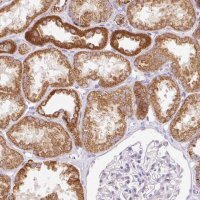Anti-ETNK2 antibody produced in rabbit 