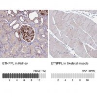 Anti-ETNPPL antibody produced in rabbit 