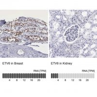Anti-ETV6 antibody produced in rabbit 