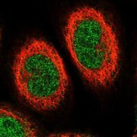 Anti-ETV7 antibody produced in rabbit 