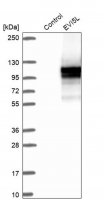 Anti-EVI5L antibody produced in rabbit 