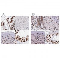 Anti-EWSR1 antibody produced in rabbit HPA051771-100UL