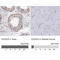 Anti-EXOSC3 antibody produced in rabbit 