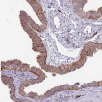Anti-EXOSC8 antibody produced in rabbit HPA039702-100UL