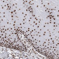 Anti-EYA2 antibody produced in rabbit