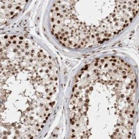 Anti-EYA2 antibody produced in rabbit