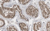 Anti-EZHIP/CXorf67 Antibody, clone 1J8 ZooMAb� Rabbit Monoclonal 