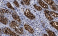 Anti-Ezrin Antibody, clone 1D15 ZooMAb� Rabbit Monoclonal 