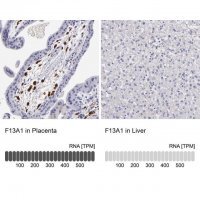 Anti-F13A1 antibody produced in rabbit 