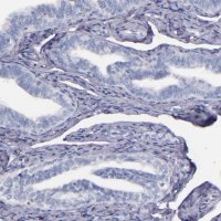 Anti-F13A1 antibody produced in rabbit 