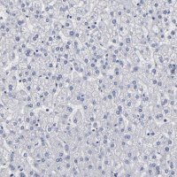 Anti-FABP4 antibody produced in rabbit 
