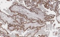 Anti-FAK Antibody, clone 1D14 ZooMAb� Rabbit Monoclonal 