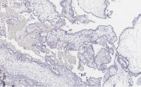 Anti-FAK Antibody, clone 1D14 ZooMAb� Rabbit Monoclonal 