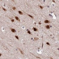 Anti-FAM103A1 antibody produced in rabbit 