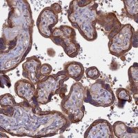 Anti-FAM126A antibody produced in rabbit 