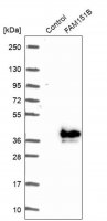 Anti-FAM151B antibody produced in rabbit 