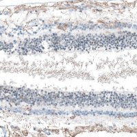 Anti-FAM161A antibody produced in rabbit 
