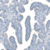Anti-FAM161A antibody produced in rabbit