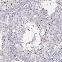 Anti-FAM166A antibody produced in rabbit 