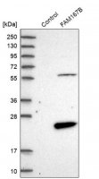 Anti-FAM167B antibody produced in rabbit HPA029398-100UL