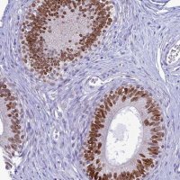 Anti-FAM169A antibody produced in rabbit 