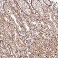 Anti-FAM192A antibody produced in rabbit