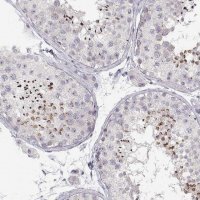Anti-FAM205A antibody produced in rabbit 