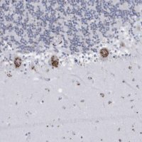 Anti-FAM207A antibody produced in rabbit 