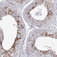 Anti-FAM216A antibody produced in rabbit 