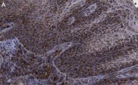 Anti-FAM49A Antibody, clone 2D6 ZooMAb� Rabbit Monoclonal 