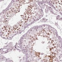 Anti-FAM71A antibody produced in rabbit 