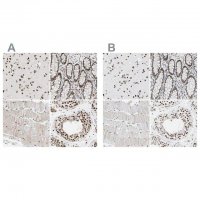Anti-FAM98B antibody produced in rabbit HPA008320-100UL