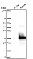 Anti-FAM9B antibody produced in rabbit 