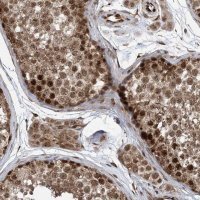 Anti-FAM9B antibody produced in rabbit 