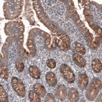 Anti-FASTKD1 antibody produced in rabbit