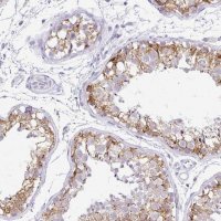 Anti-FATE1 antibody produced in rabbit