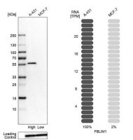 Anti-FBLIM1 antibody produced in rabbit 