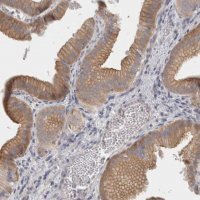 Anti-FBLIM1 antibody produced in rabbit 