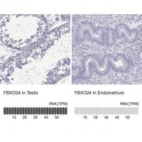 Anti-FBXO24 antibody produced in rabbit 